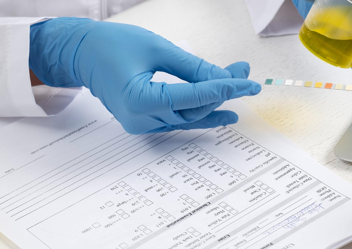 Exame toxicológico: dados comprovam por que a medida salva vidas e tem apoio da sociedade - Foto: Freepik
